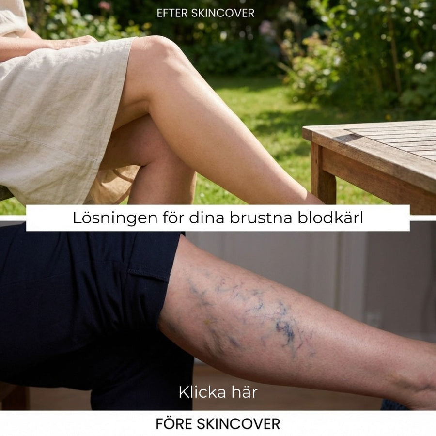 Så ser det ut på riktig hud